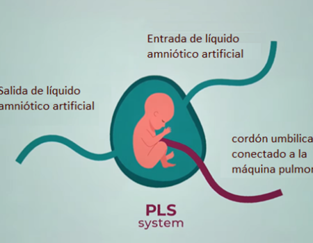 La ectogénesis: úteros artificiales para apoyar a bebés prematuros
