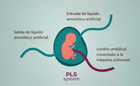 La ectogénesis: úteros artificiales para apoyar a bebés prematuros