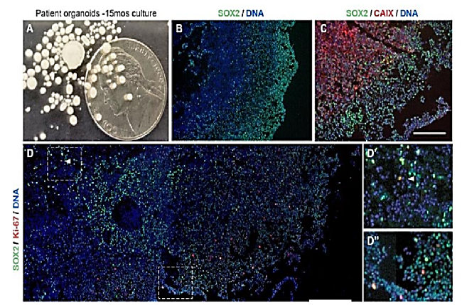 Molecular analysis of chemokines and their receptors to assess the metastatic potential in breast cancer cells using cell traps in vitro and in vivo